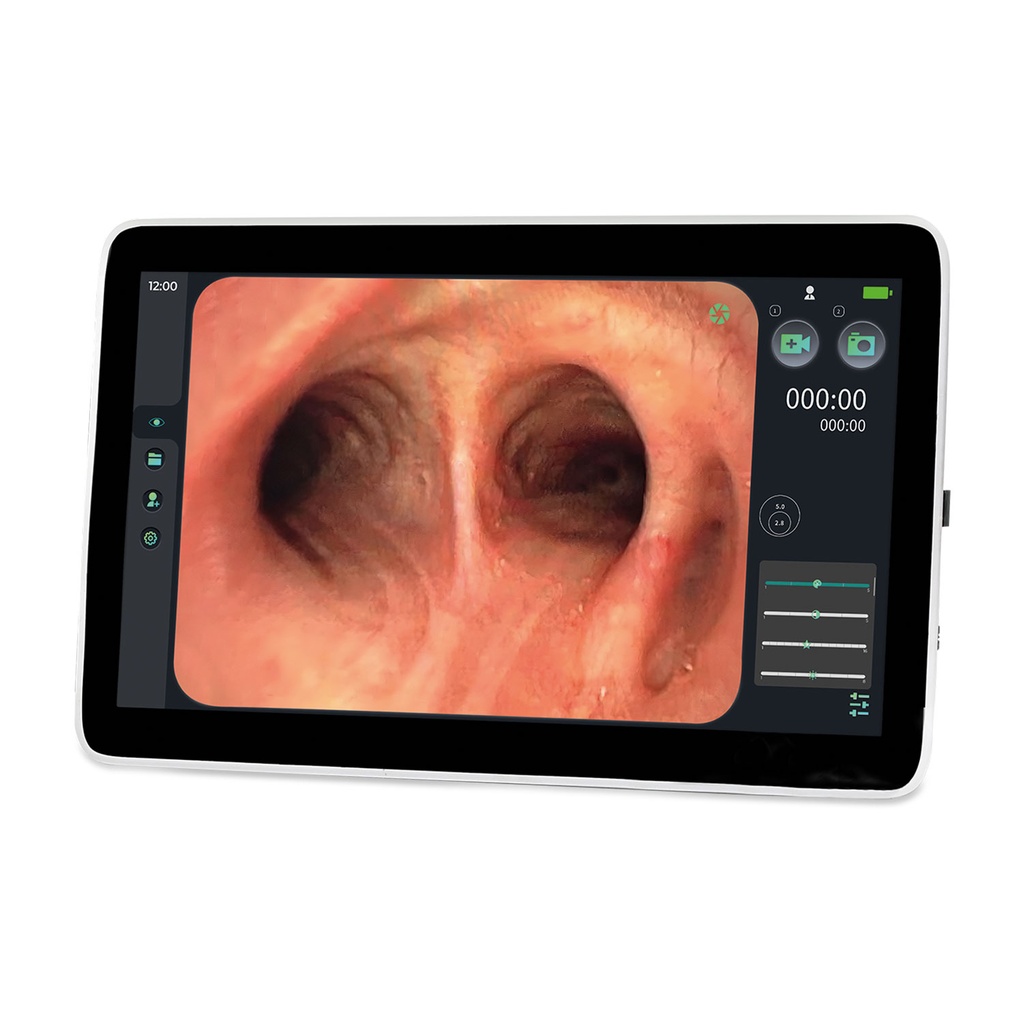[307000] Monitor endoscopia EickView SD, touchscreen15,6"