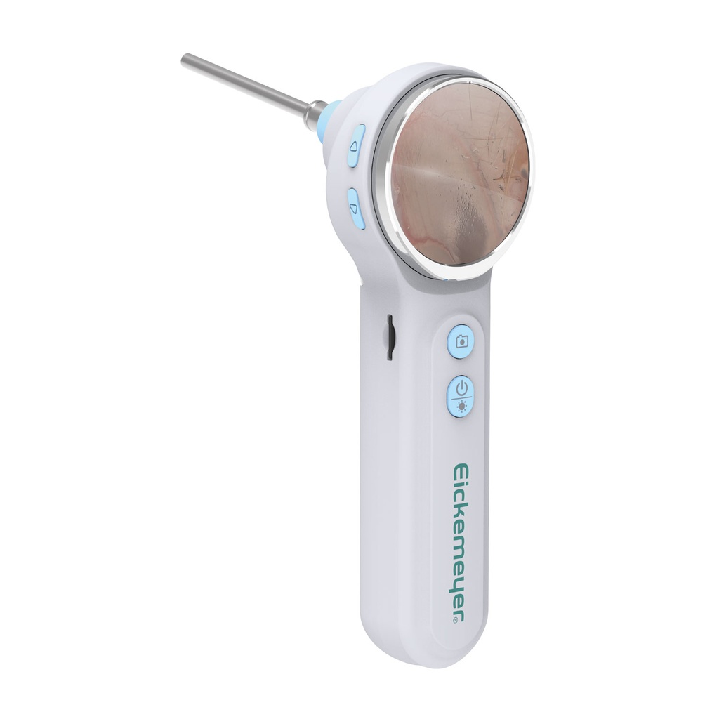 EickView OTO - Vidéo-otoscope digital