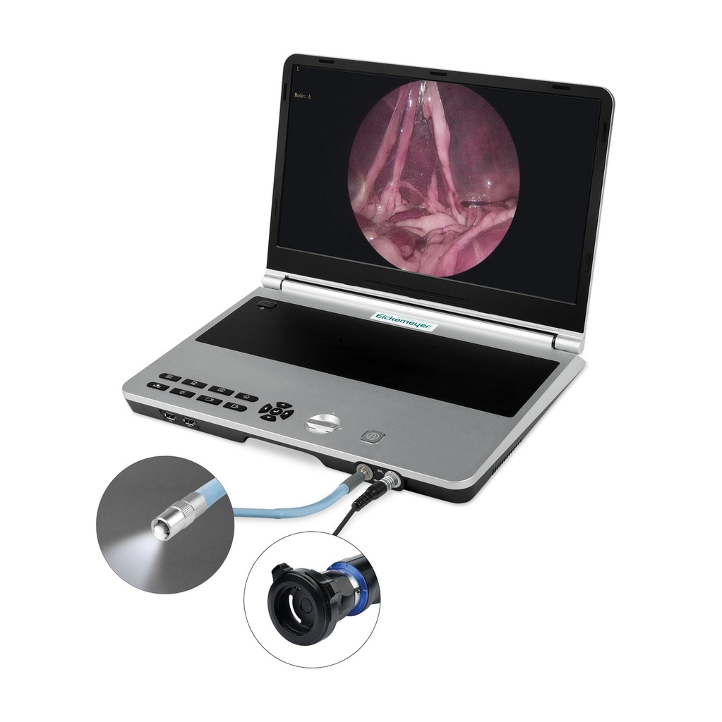 EickView 4-en-1 Système d'endoscopie compact 